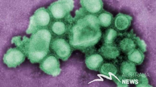 Sydney: Dịch cúm và viêm dạ dày bùng phát khiến gần 2,000 người phải nhập viện
