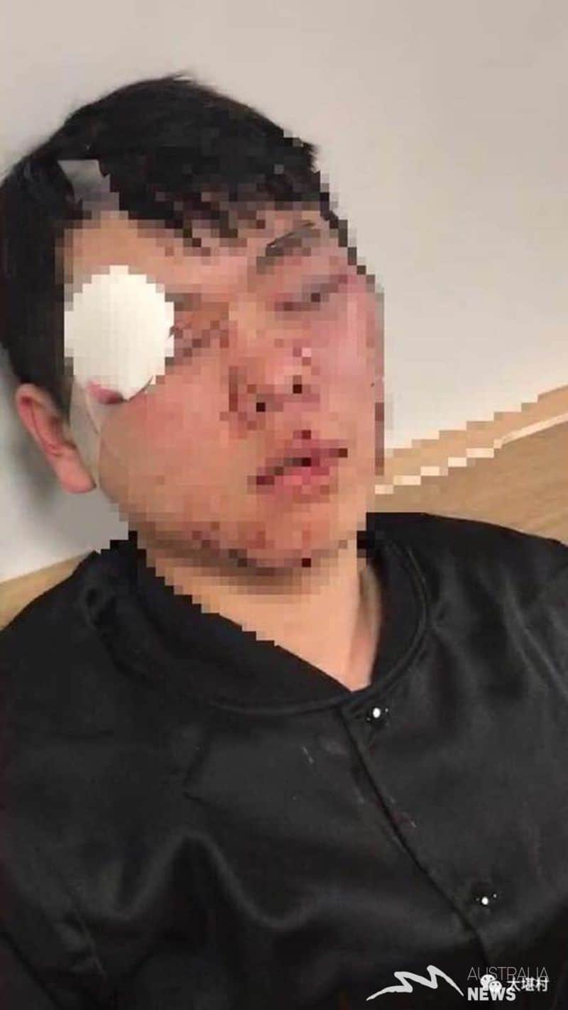 Canberra: Nhóm học sinh Trung Quốc bị tấn công tại trạm xe buýt
