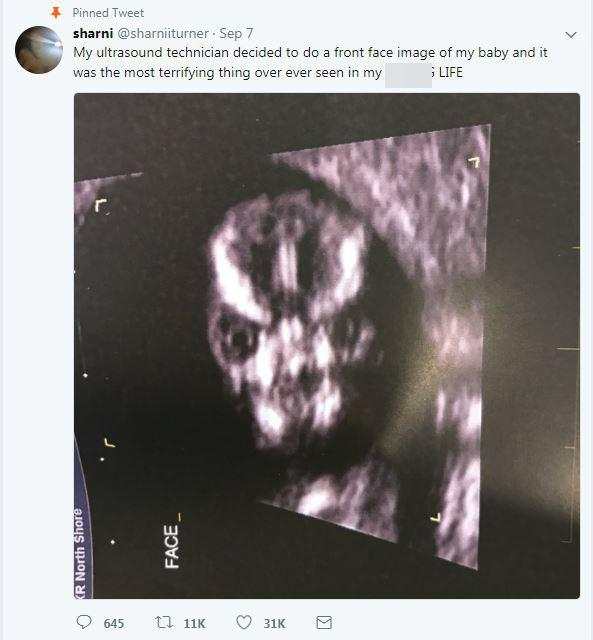Mẹ trẻ Úc vừa chia sẻ ảnh siêu âm, cư dân mạng liền hốt hoảng gọi đứa trẻ trong bụng cô là “ác quỷ” - Ảnh 2.