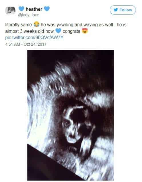 Mẹ trẻ Úc vừa chia sẻ ảnh siêu âm, cư dân mạng liền hốt hoảng gọi đứa trẻ trong bụng cô là “ác quỷ” - Ảnh 5.