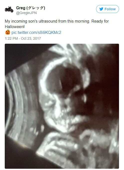 Mẹ trẻ Úc vừa chia sẻ ảnh siêu âm, cư dân mạng liền hốt hoảng gọi đứa trẻ trong bụng cô là “ác quỷ” - Ảnh 7.