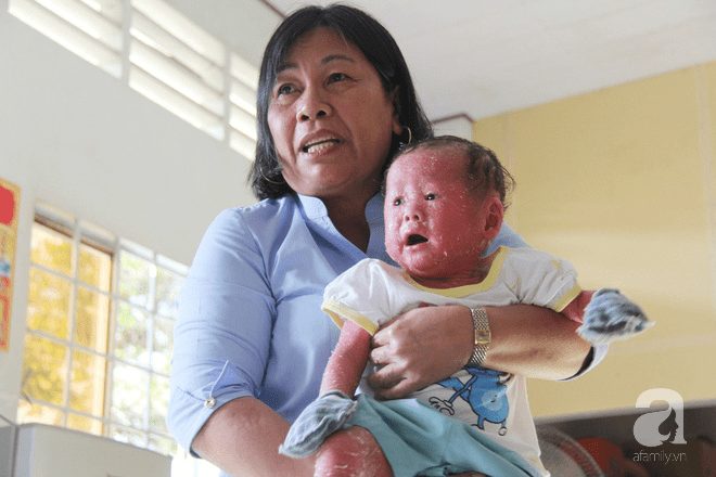 Người đầy vẩy ngứa như da trăn, bé gái 14 tháng tuổi bị bố mẹ bỏ rơi nên không có tiền chữa trị - Ảnh 7.