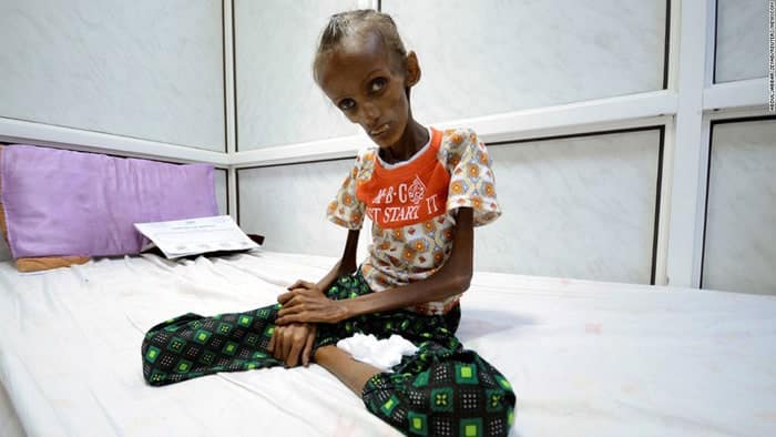 Ở Yemen, đến khóc cũng không còn nước mắt vì đói khát - Ảnh 2.