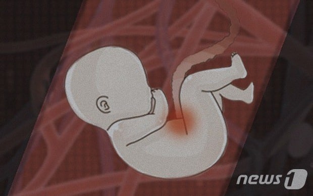 Hàn Quốc: Đến bệnh viện để tiêm chất dưỡng thai, người phụ nữ Việt tỉnh dậy mới biết đã bị bác sĩ phá thai nhầm - Ảnh 2.