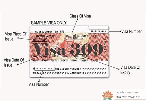 Visa 309