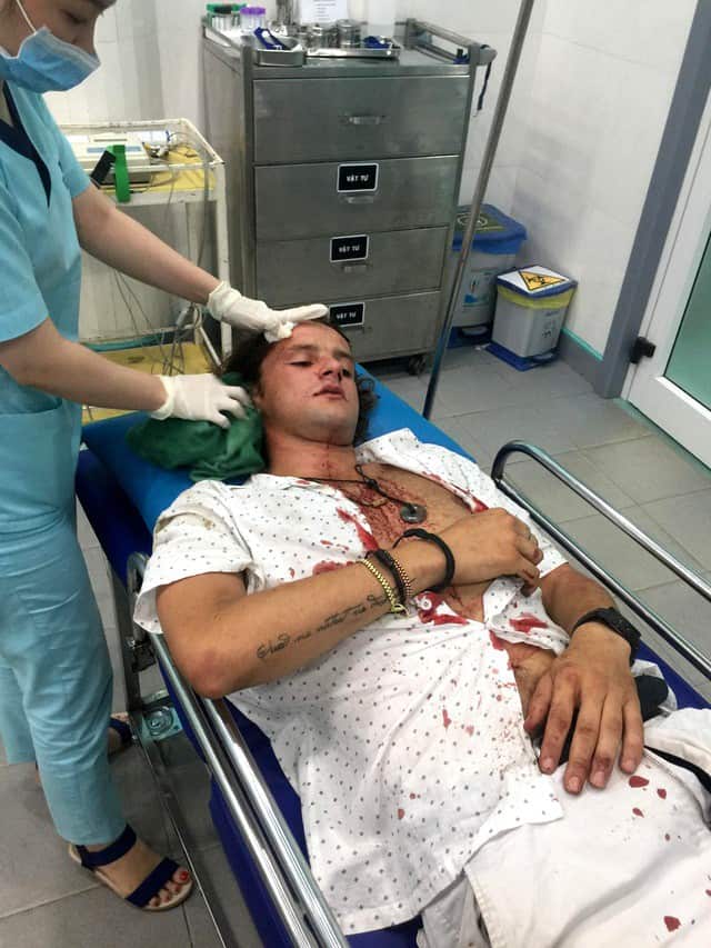 Anh Margan nhập viện khâu 11 mũi do bị đánh