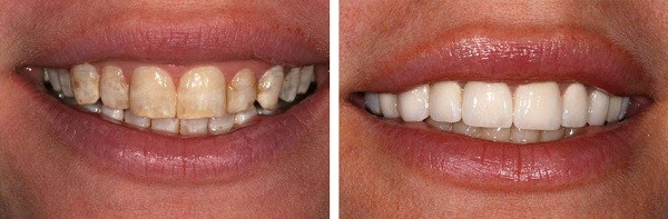 13 dấu hiệu ‘tố cáo’ cơ thể bạn đang thiếu vitamin trầm trọng, cần bổ sung ngay và luôn