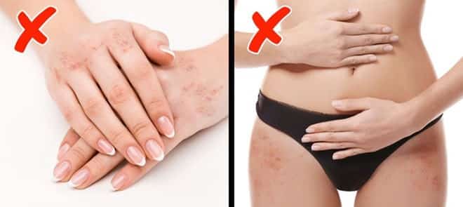 13 dấu hiệu ‘tố cáo’ cơ thể bạn đang thiếu vitamin trầm trọng, cần bổ sung ngay và luôn