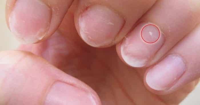 13 dấu hiệu ‘tố cáo’ cơ thể bạn đang thiếu vitamin trầm trọng, cần bổ sung ngay và luôn