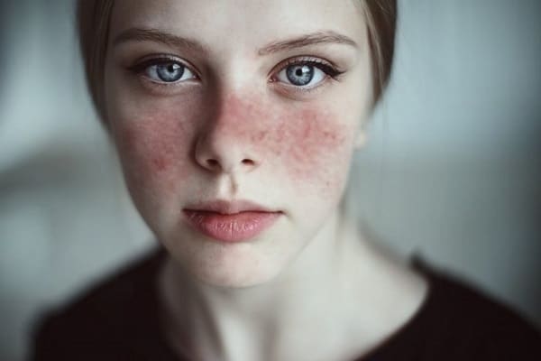 13 dấu hiệu ‘tố cáo’ cơ thể bạn đang thiếu vitamin trầm trọng, cần bổ sung ngay và luôn