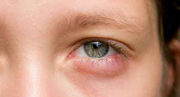 13 dấu hiệu ‘tố cáo’ cơ thể bạn đang thiếu vitamin trầm trọng, cần bổ sung ngay và luôn