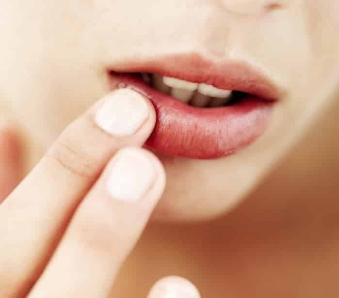 10 dấu hiệu cảnh báo bệnh qua sự thay đổi sắc diện trên khuôn mặt