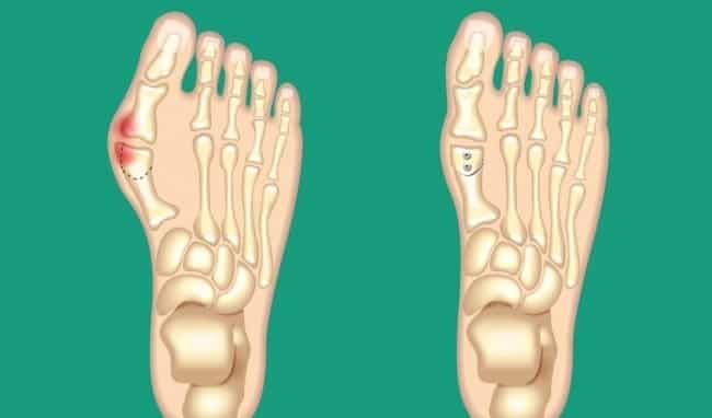 10 thay đổi nhỏ trong cơ thể có thể chỉ ra các bệnh mà bạn cần lưu ý
