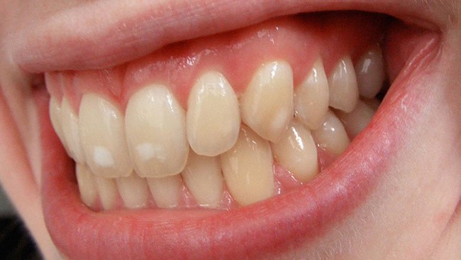 10 thay đổi nhỏ trong cơ thể có thể chỉ ra các bệnh mà bạn cần lưu ý