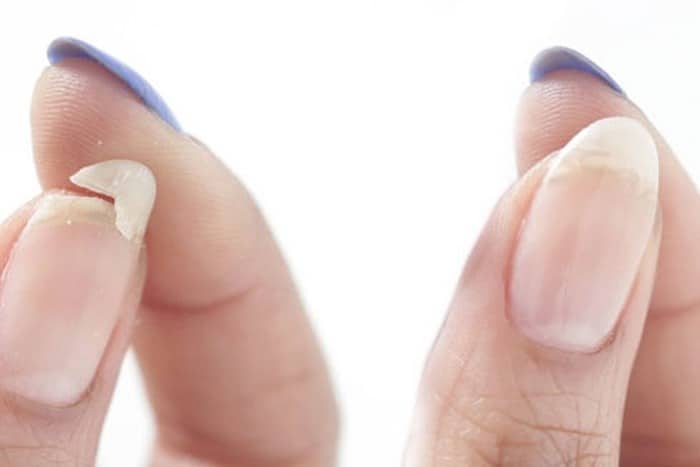 10 thay đổi nhỏ trong cơ thể có thể chỉ ra các bệnh mà bạn cần lưu ý