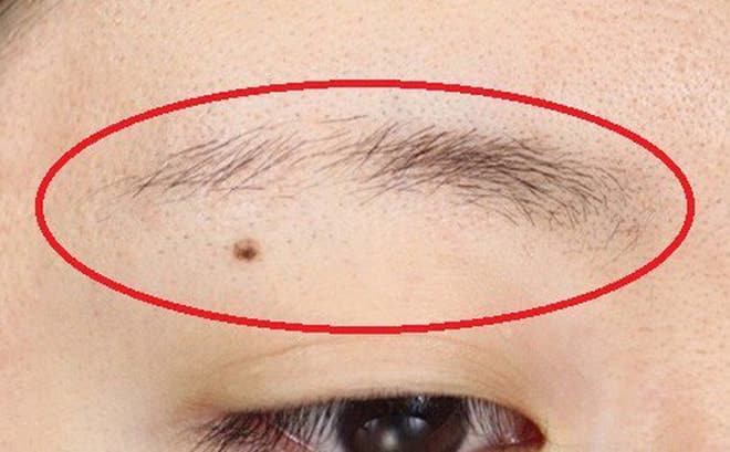 10 thay đổi nhỏ trong cơ thể có thể chỉ ra các bệnh mà bạn cần lưu ý
