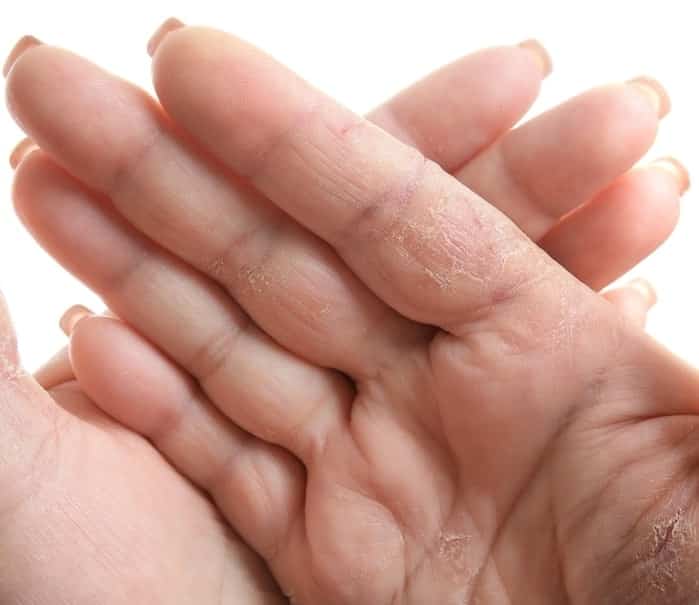 10 thay đổi nhỏ trong cơ thể có thể chỉ ra các bệnh mà bạn cần lưu ý