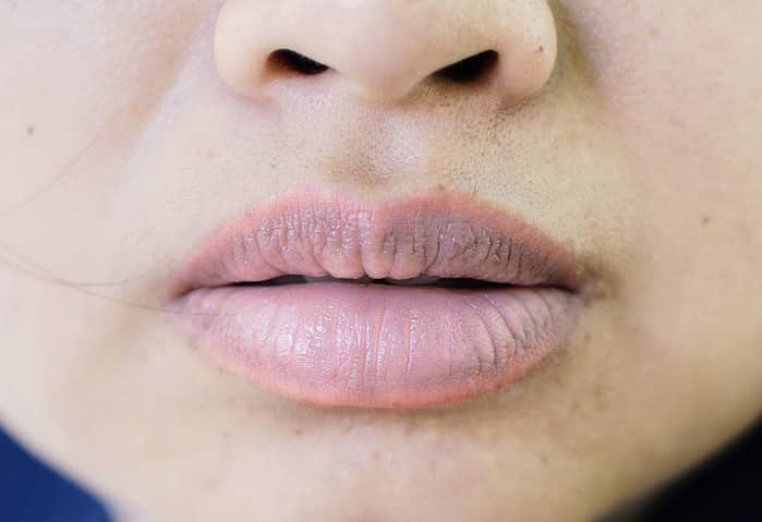 10 thay đổi nhỏ trong cơ thể có thể chỉ ra các bệnh mà bạn cần lưu ý