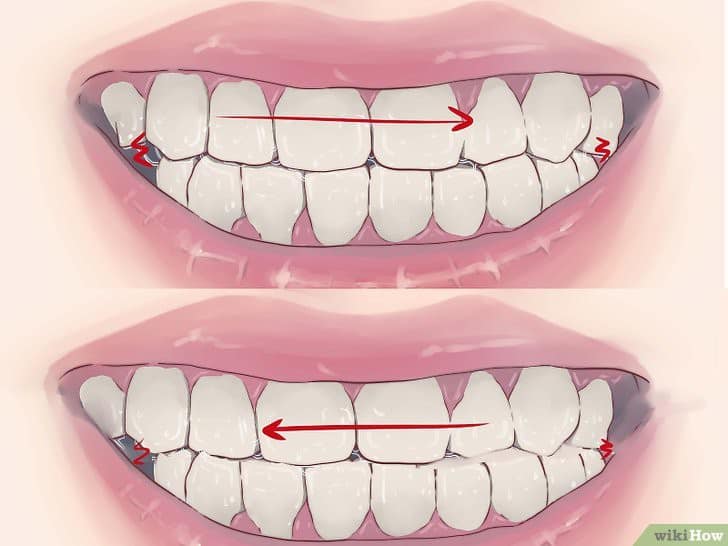 5 triệu chứng bất thường khi ngủ cảnh báo những căn bệnh nguy hiểm mà bạn tuyệt đối không nên chủ quan bỏ qua - Ảnh 2. 5 triệu chứng bất thường khi ngủ cảnh báo những căn bệnh nguy hiểm mà bạn tuyệt đối không nên chủ quan bỏ qua - Ảnh 2.