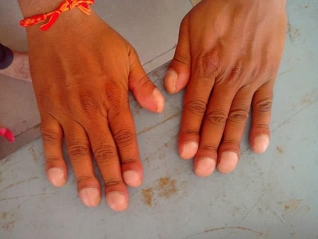  Móng tay cũng được coi là một dấu hiệu cực kì "đáng ngờ"