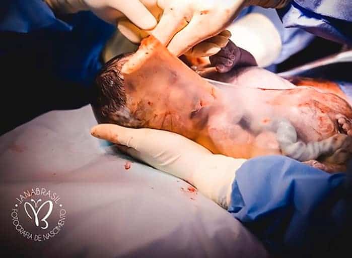 Em bé vừa nằm trong túi ối vừa làm trò khiến nhiều người bật cười