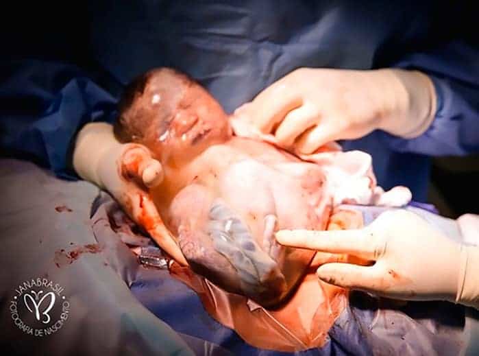 Em bé vừa nằm trong túi ối vừa làm trò khiến nhiều người bật cười