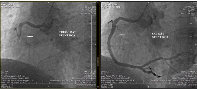 Việt Nam: Cứu sống du khách Úc suýt đột tử khi vừa xuống sân bay - ảnh 1
