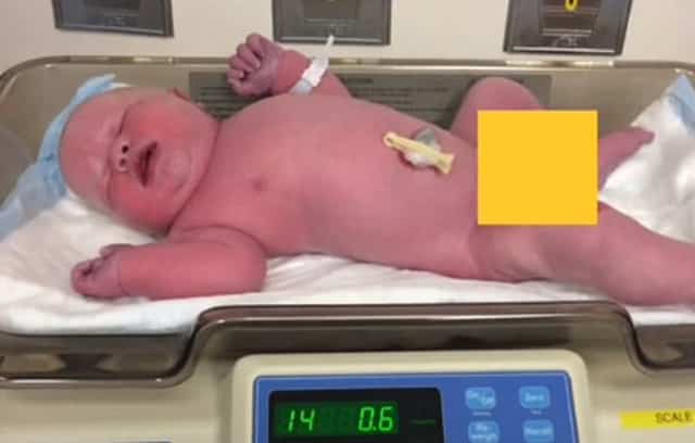 Bé trai chào đời nặng 6,4 kg - Ảnh 2. Bé trai chào đời nặng 6,4 kg - Ảnh 2.