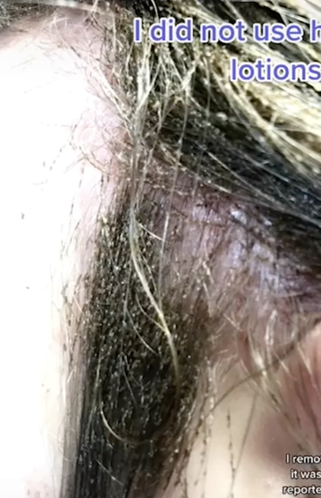Mang quả đầu đỏ rát, lúc nhúc hàng ngàn con chấy đến salon, cô bé khiến chuyên gia khóc thét vì sốc và kết quả đáng kinh ngạc sau đó - Ảnh 1.