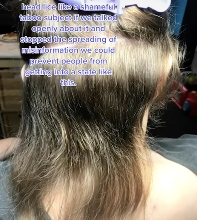 Mang quả đầu đỏ rát, lúc nhúc hàng ngàn con chấy đến salon, cô bé khiến chuyên gia khóc thét vì sốc và kết quả đáng kinh ngạc sau đó - Ảnh 5.