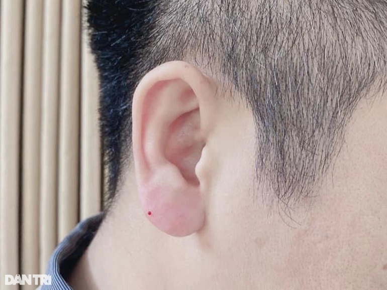 Lạ lùng trào lưu đàn ông đua nhau đi tiêm tai Phật Di Lặc - 3