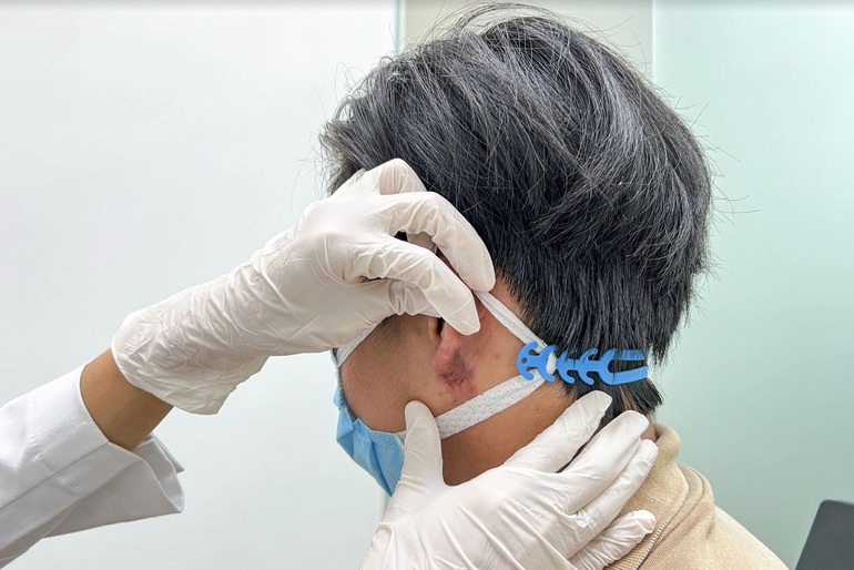 Lạ lùng trào lưu đàn ông đua nhau đi tiêm tai Phật Di Lặc - 4