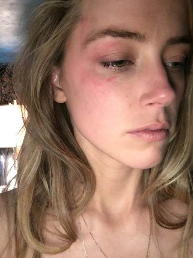 Amber Heard - Cô vợ đánh đập Johnny Depp là ai? Mỹ nhân đẹp nhất hành tinh bạo hành 2 cuộc hôn nhân, ngoại tình tay 3 với tỷ phú Twitter - Ảnh 15.