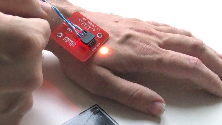 Người đàn ông cấy 32 con chip dưới da để thay thế thẻ ngân hàng - 1