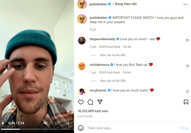 Justin Bieber bị liệt nửa mặt do nhiễm vi-rút hiếm gặp, phải hủy toàn bộ show diễn ảnh 1