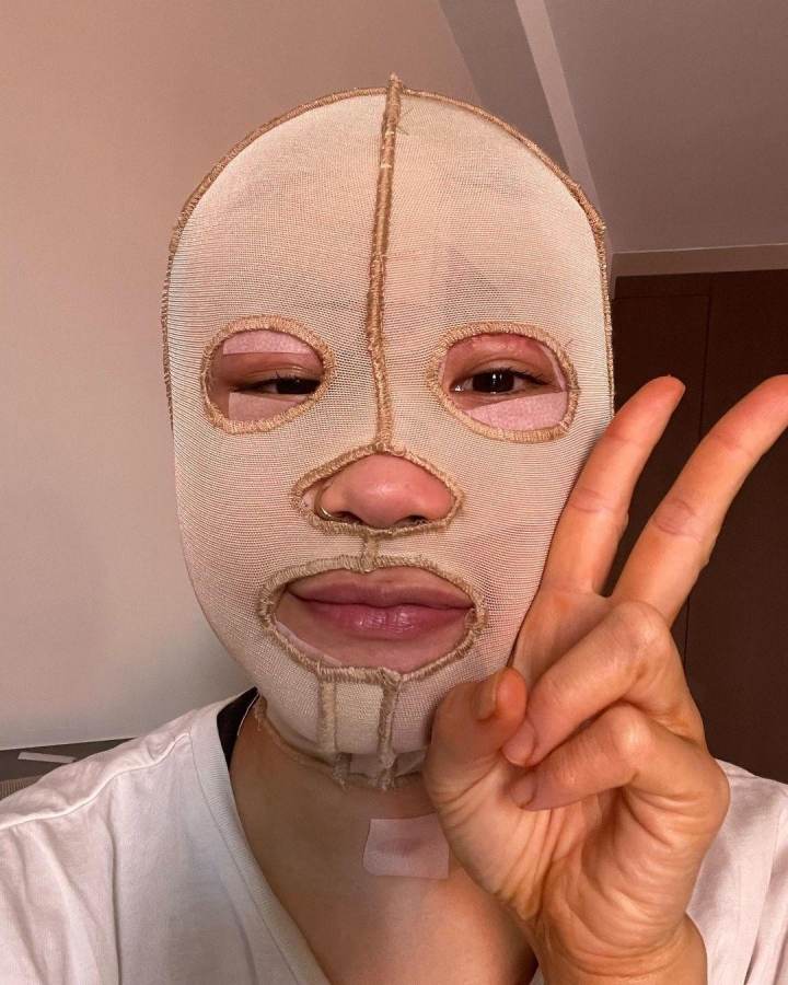 Cô gái bị hủy hoại mặt vì sơ suất từ bạn trai: Hành trình chữa lành đầy nước mắt - 4